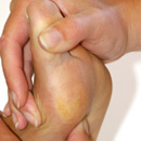 sportpodotherapie