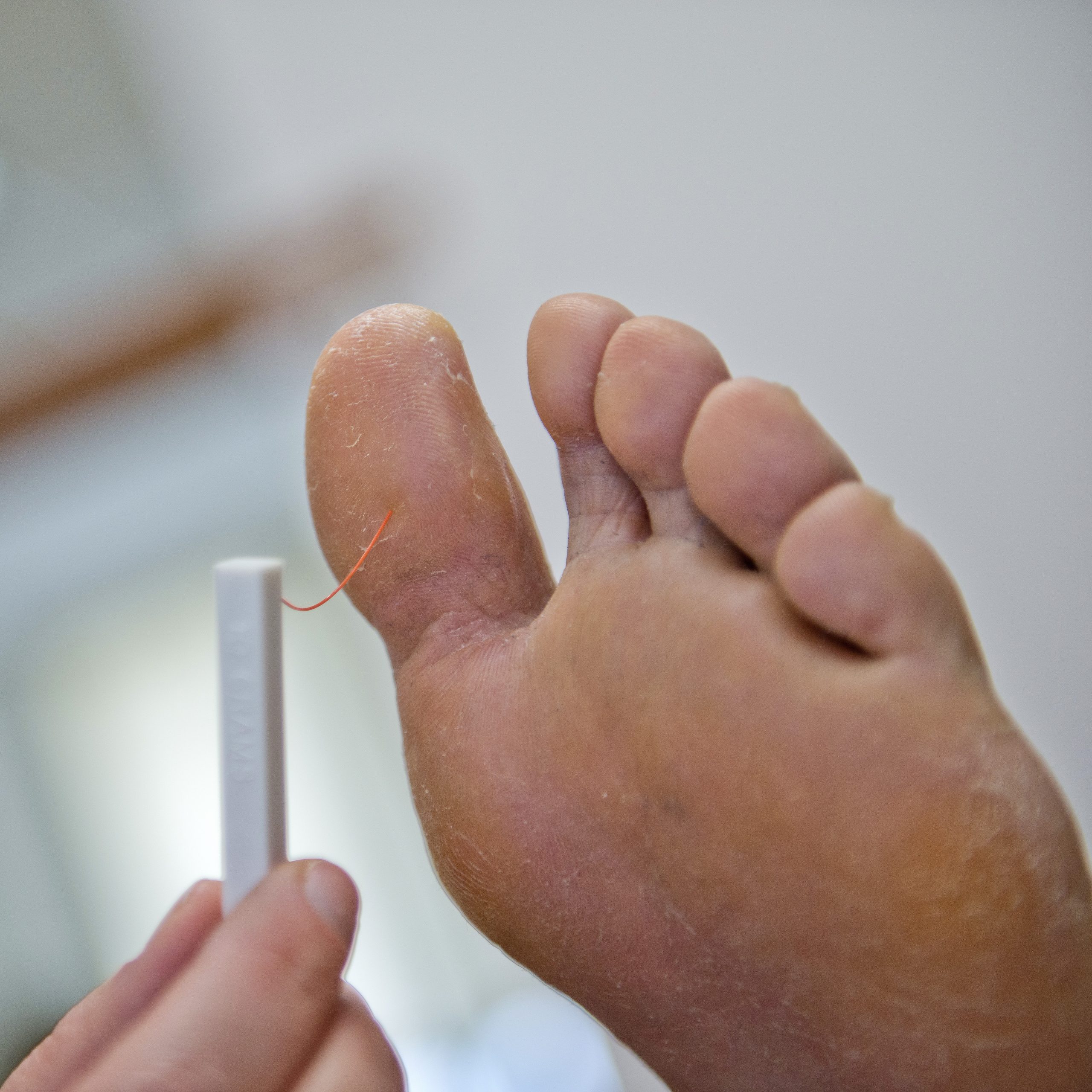 MVF-6533-659 Preventieve voetzorg